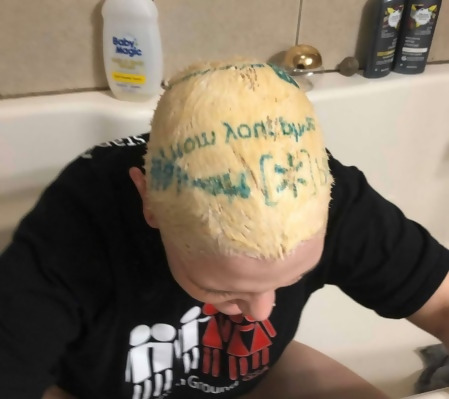 someone bleaching their hair got ink from a walmart bag stuck to their head